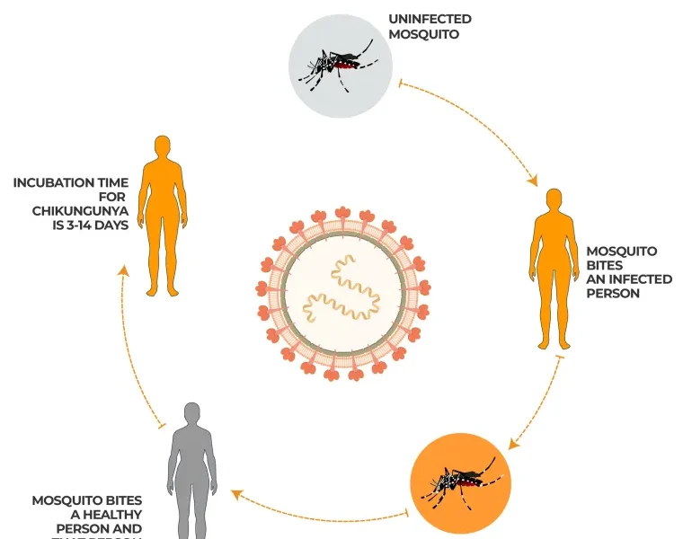 Mbi 240 mijë raste me dhjetëra viktima  çfarë është virusi Chikungunya