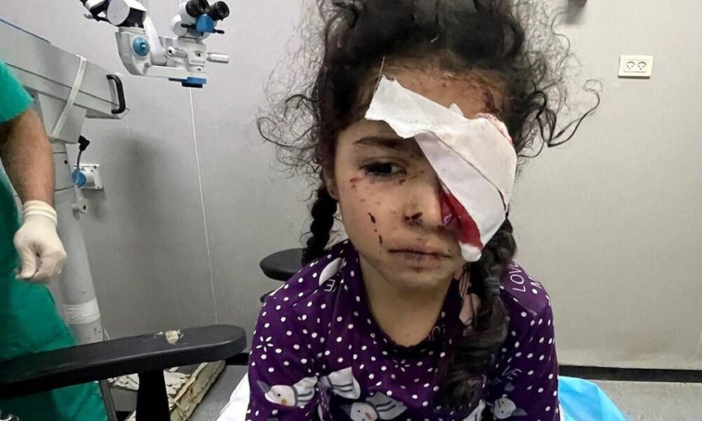 Shifra tronditëse  mijëra pacientë sysh në Gaza  në rrezik verbërie