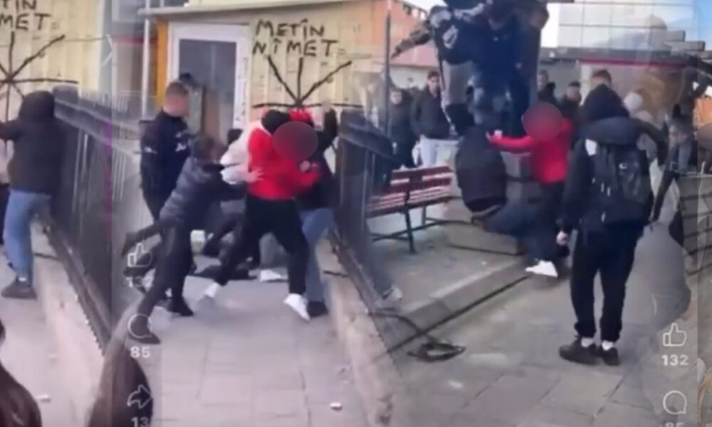 Fëmija i rrahur në Saraj përfundon me thyrje të hundës  lëndime në kokë dhe lëndime në trup