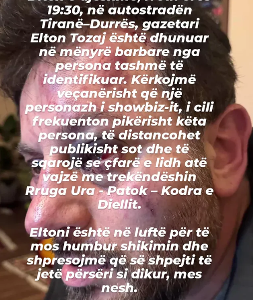 dhunohet-brutalisht-gazetari-elton-tozaj-rrezikon-te-humbase-shikimin-nga-njeri-sy