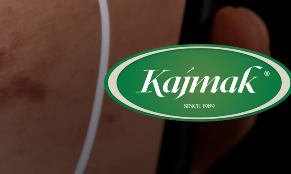 Pa kontratë dhe me pretendime se u sulmua fizikisht   rrëfimi i punëtorit që akuzon drejtorin për dhunë në kompaninë Kajmak