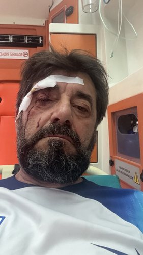 LAJMI I FUNDIT  Dhunohet gazetari Ilir Demalia  motivet ende të panjohura