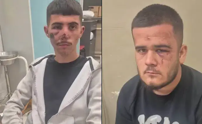 Ngjarje e rëndë në Shkup  dy të rinj dyshohet se u rrahën brutalisht nga Policia